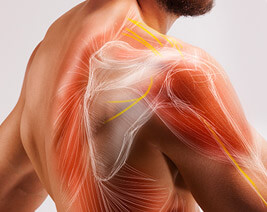 מחלות חיבור עצב שריר